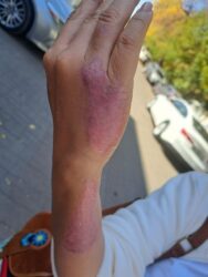 Бишкекте эркек киши аялынын колун үтүк менен күйгүзүп кыйнап, зордуктаган