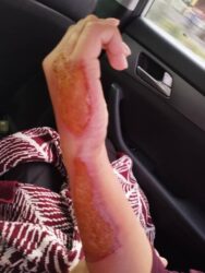 Бишкекте эркек киши аялынын колун үтүк менен күйгүзүп кыйнап, зордуктаган