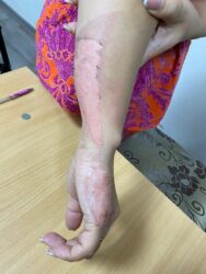 Бишкекте эркек киши аялынын колун үтүк менен күйгүзүп кыйнап, зордуктаган